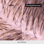 Shampoo-Limpieza-Profunda-Cabello-Graso-Scalp-Advanced-300ml