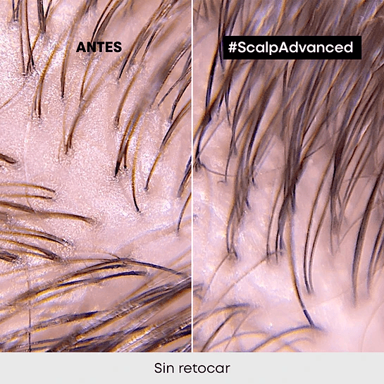 Shampoo-Limpieza-Profunda-Cabello-Graso-Scalp-Advanced-300ml